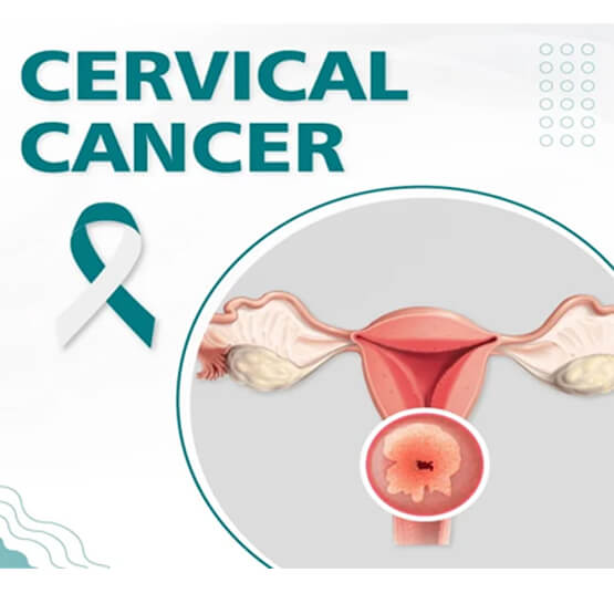 Cervical Cancer Child Help Foundation