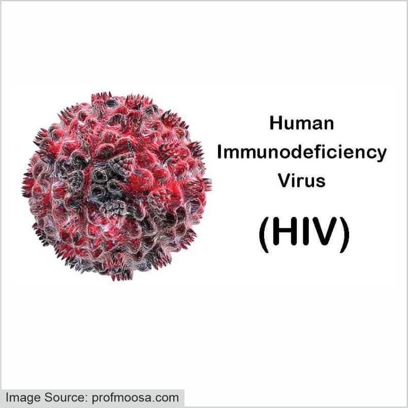 The Infection of HIV AIDS