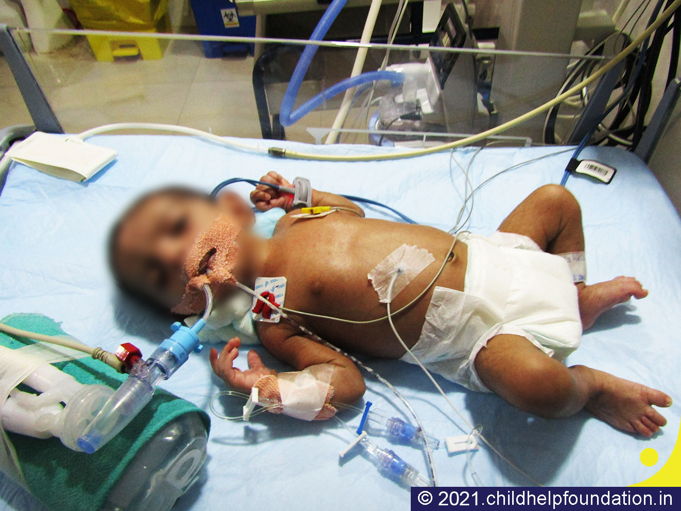 Generic placeholder image