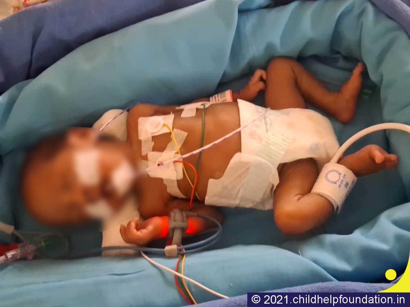 Generic placeholder image