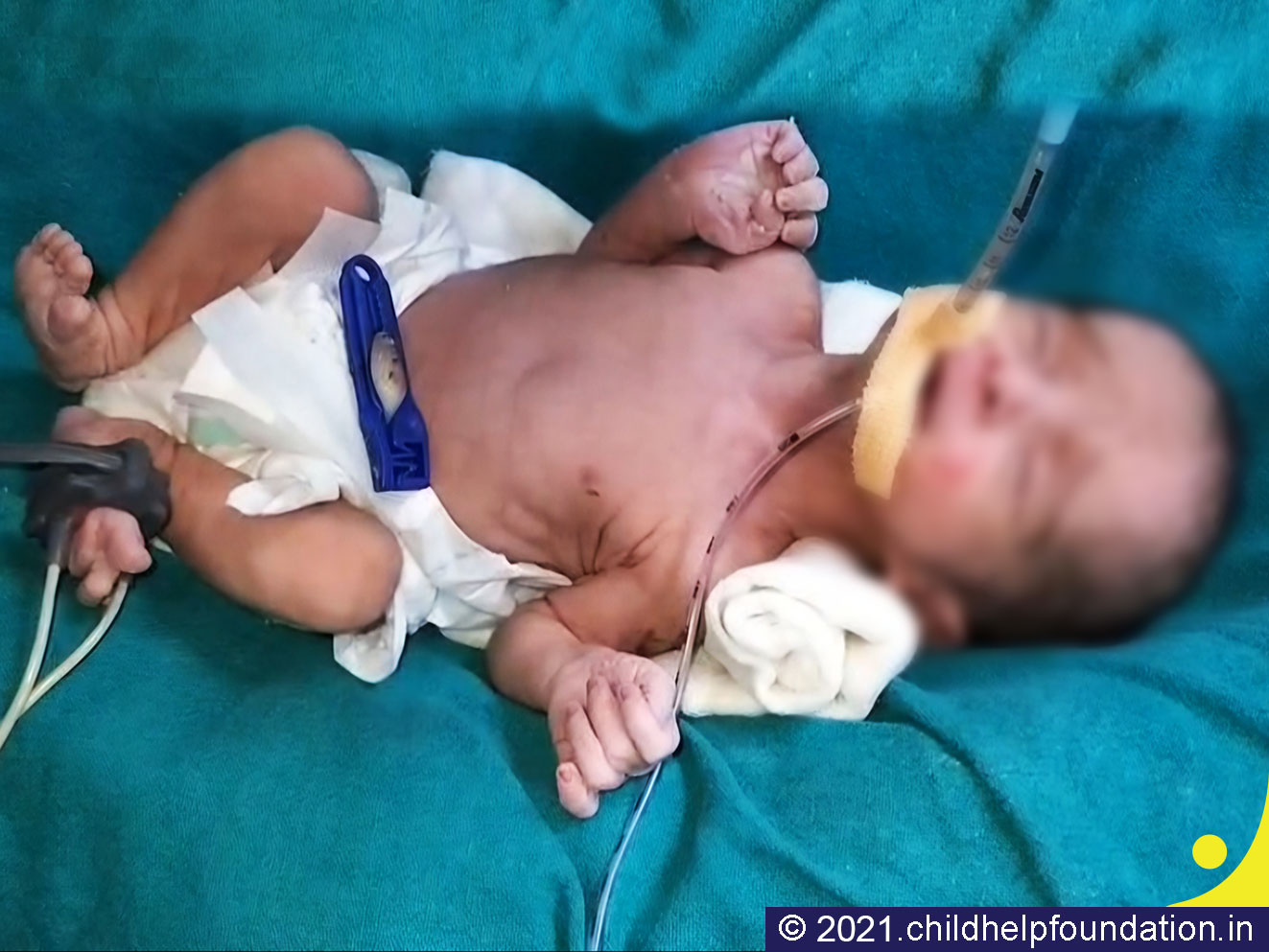 Generic placeholder image