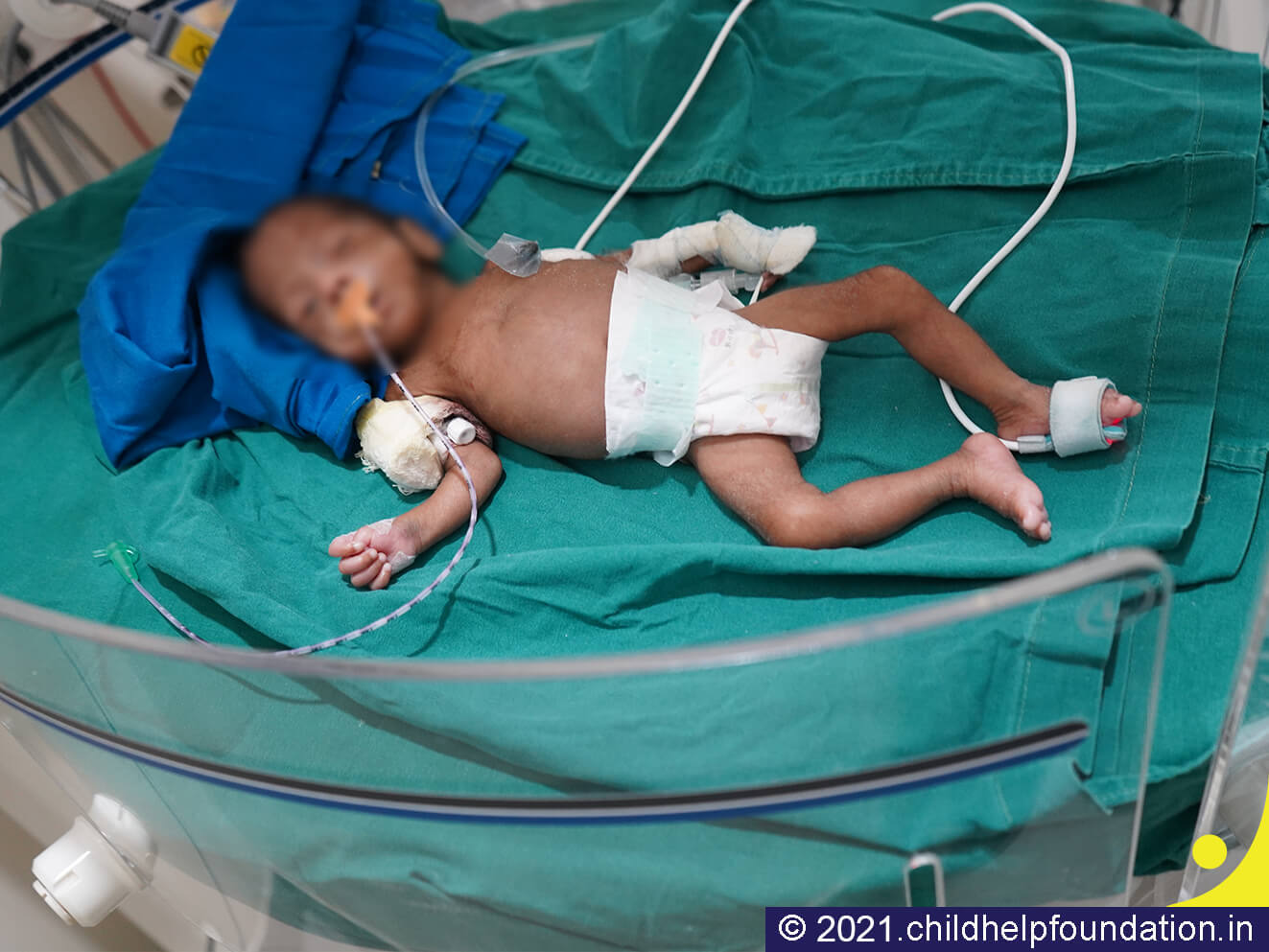 Generic placeholder image