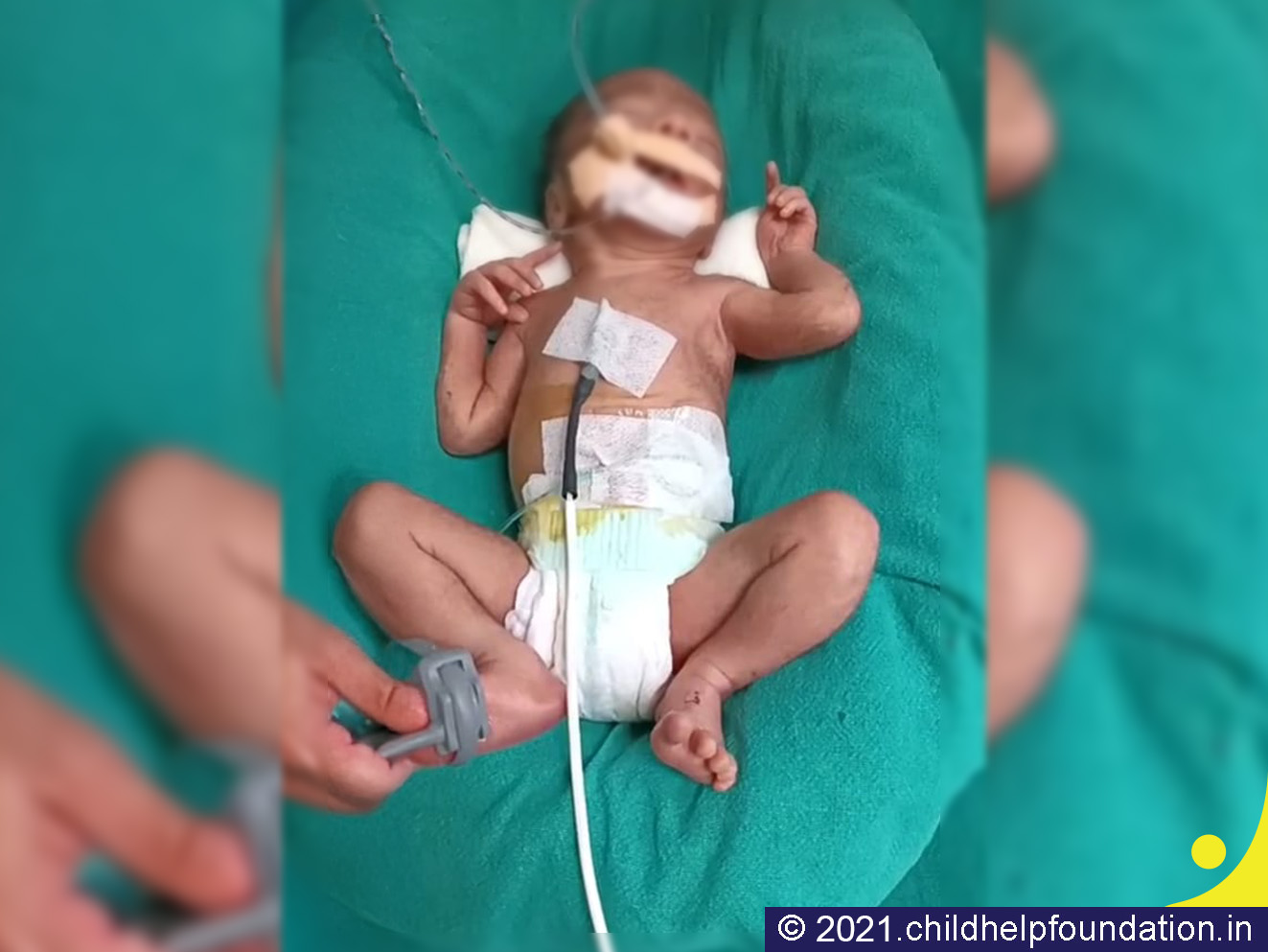 Generic placeholder image