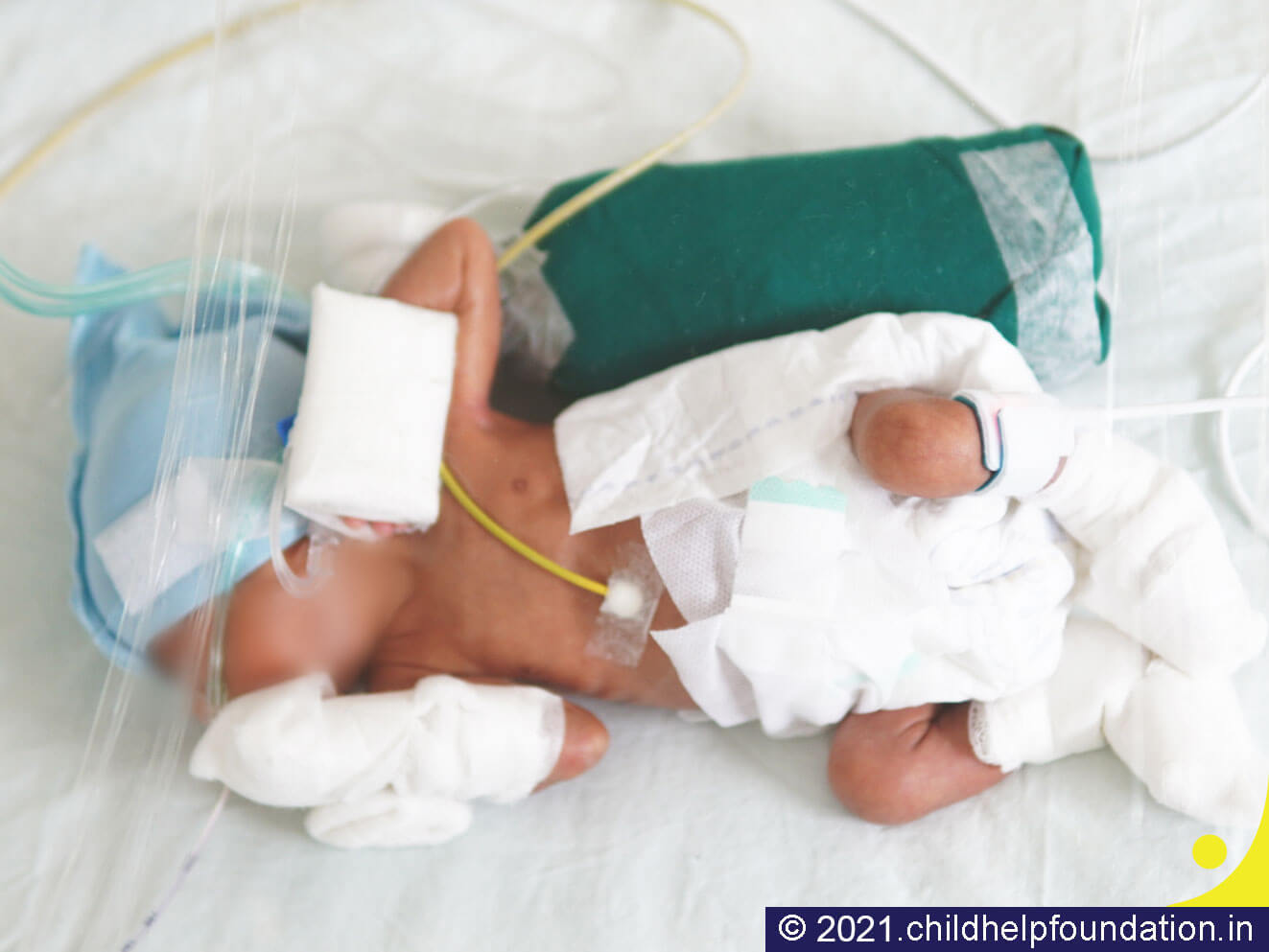 Generic placeholder image