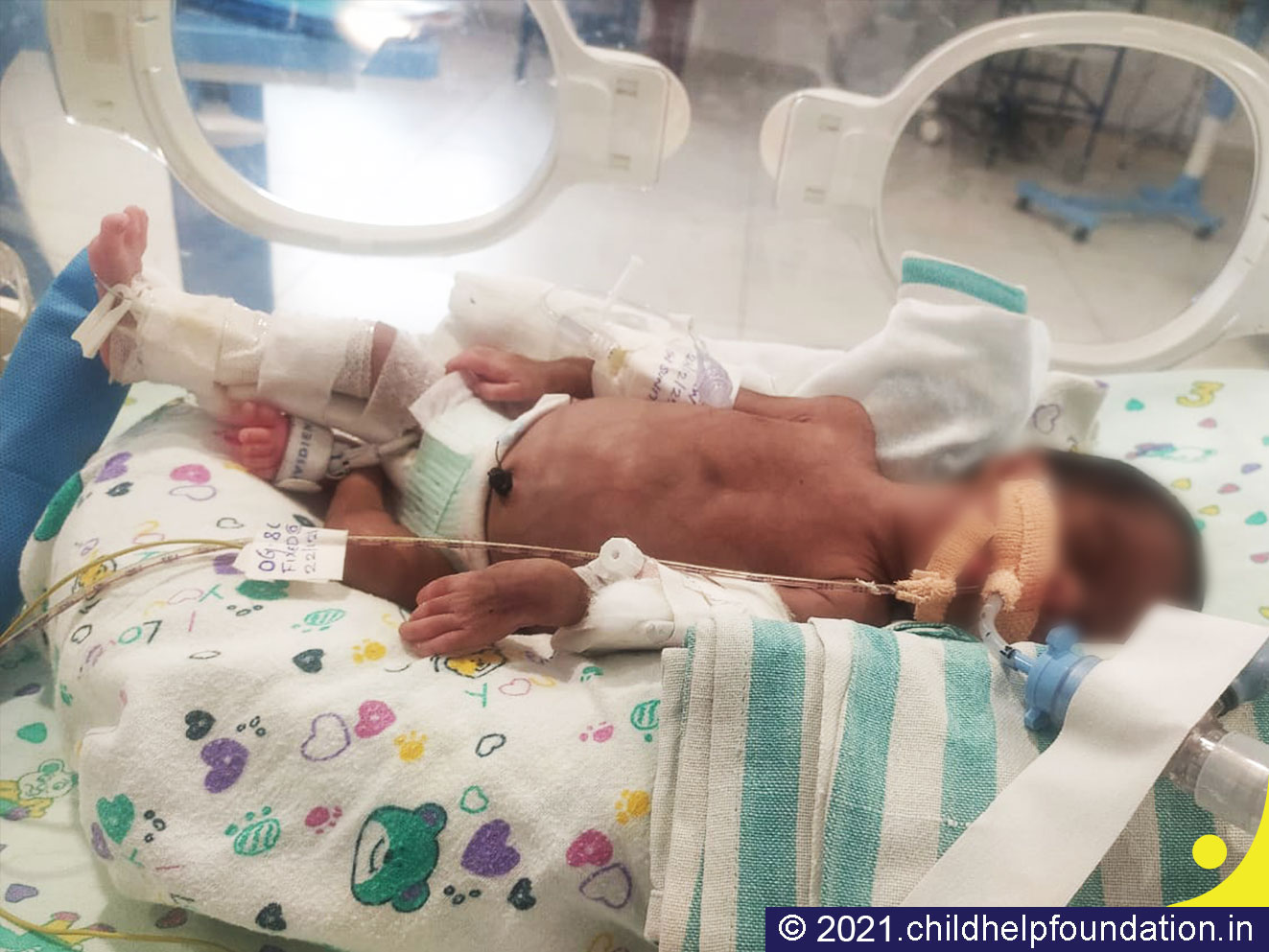 Generic placeholder image