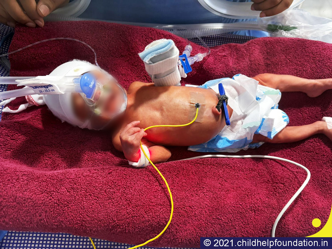 Generic placeholder image