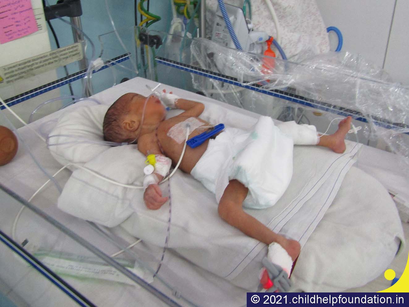 Generic placeholder image