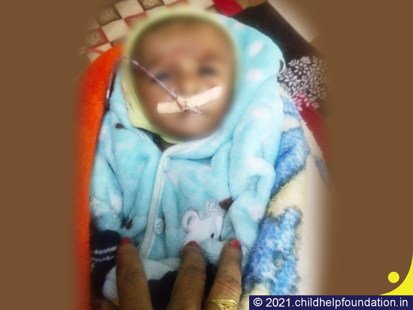 Generic placeholder image