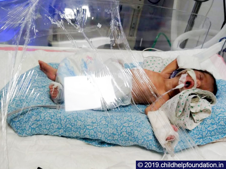 7th month premature baby