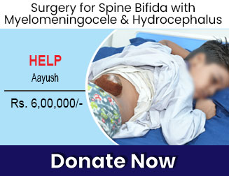 help-aayush