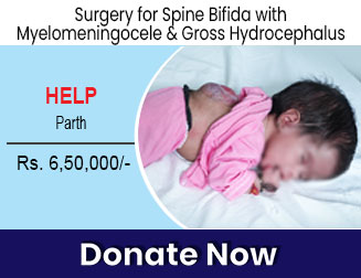 help-parth