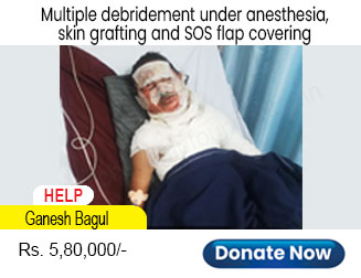 help-ganesh