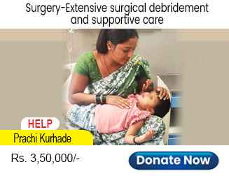 help-prachi