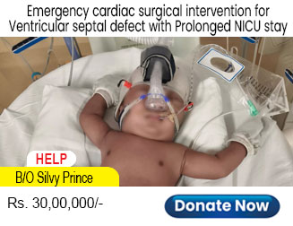 help-bo-silvy-prince
