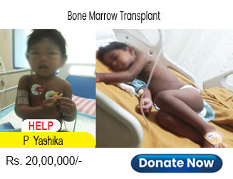 help-p-yashika