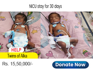 help-twins-of-alka