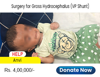 help-anvi