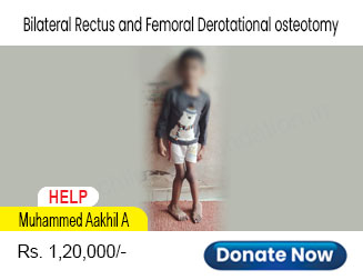 help-muhammed-aakhil-a