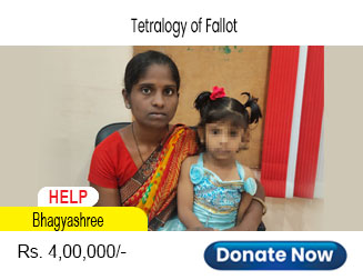help-bhagyashree
