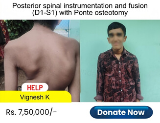 help-vignesh-k